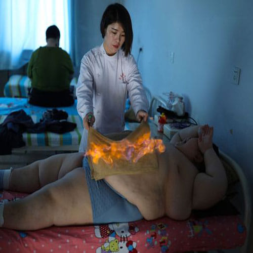 fire in body for loosing excessive weight