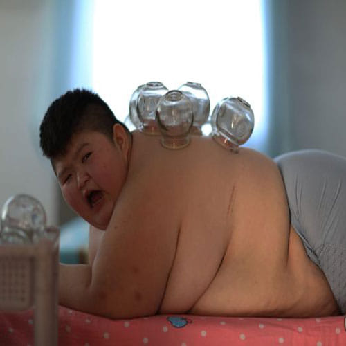 fire in body for loosing excessive weight