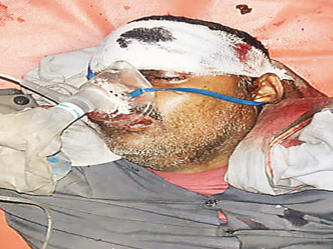 Bike rider injured uncle and nephew