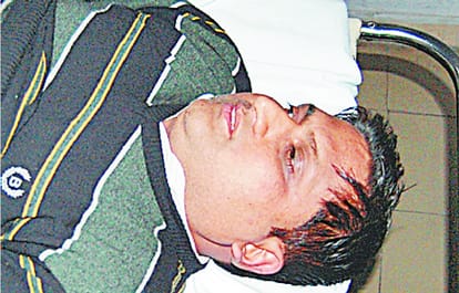 Bursai handball bullets on the chairman of the board of trade, ruckus 