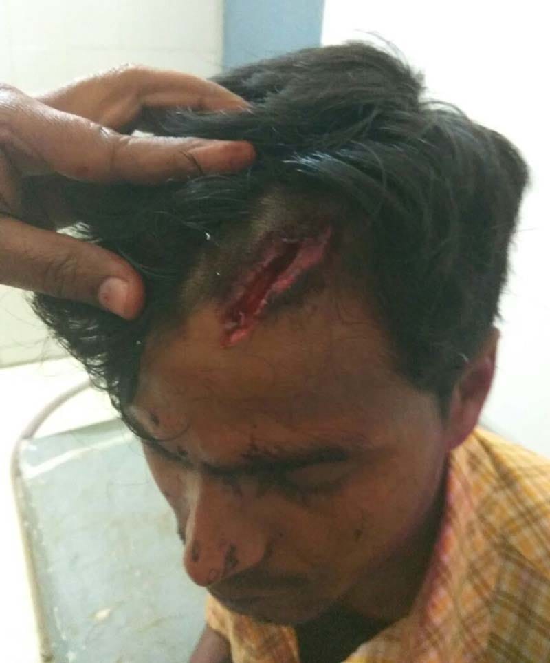 Drugs on dance, six injured