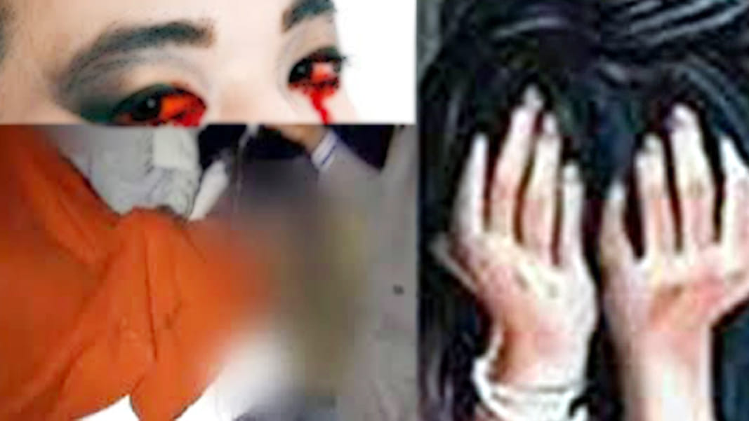 rape victim brutally beaten in unnao