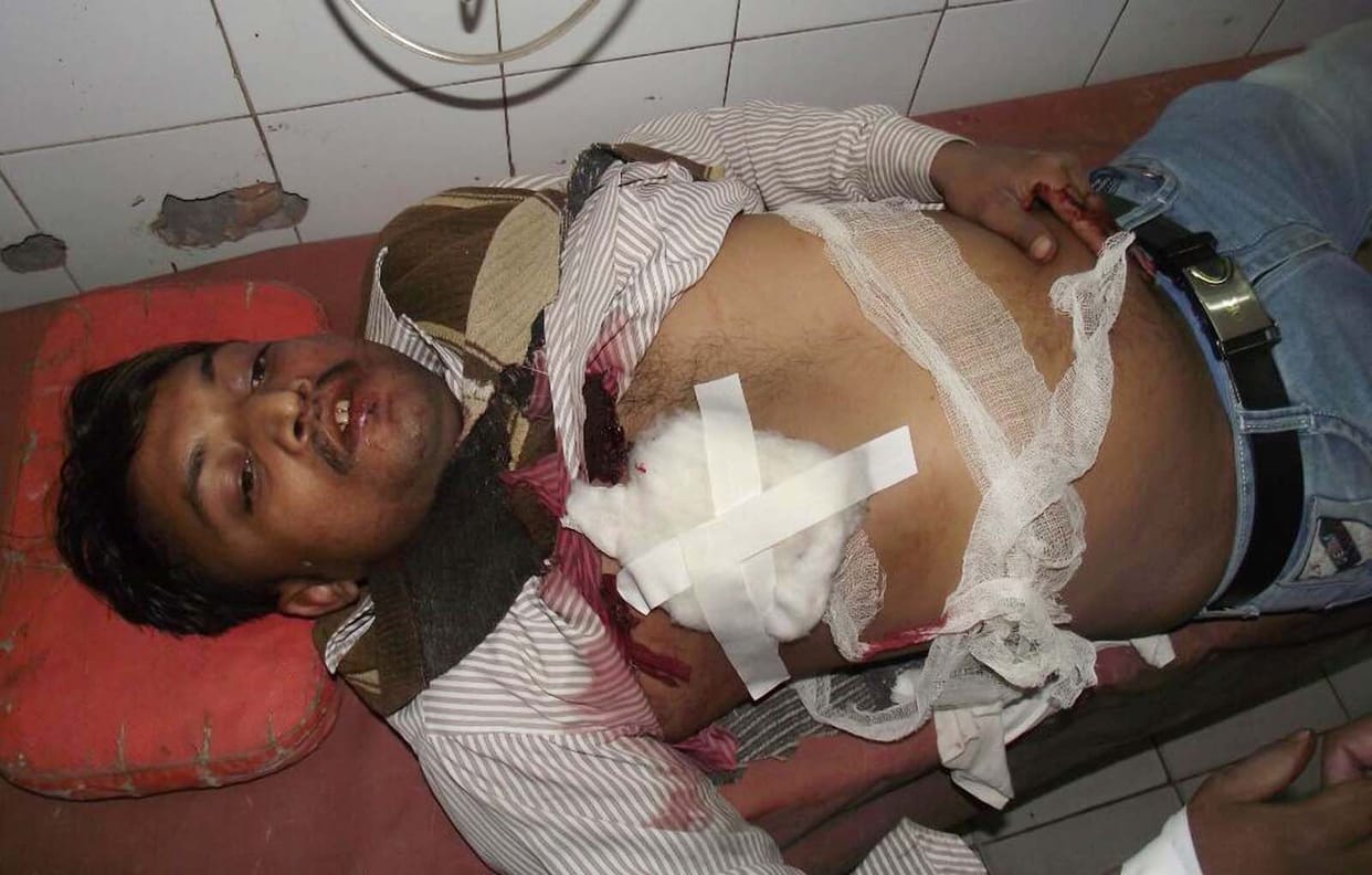 Crooks shot dead, condition critical