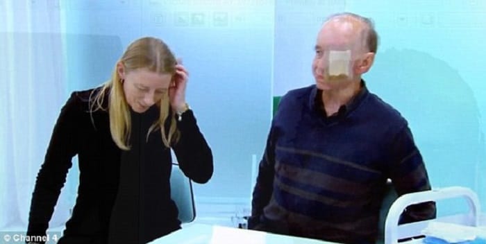 This Man Lost His Face To Nose Cancer
