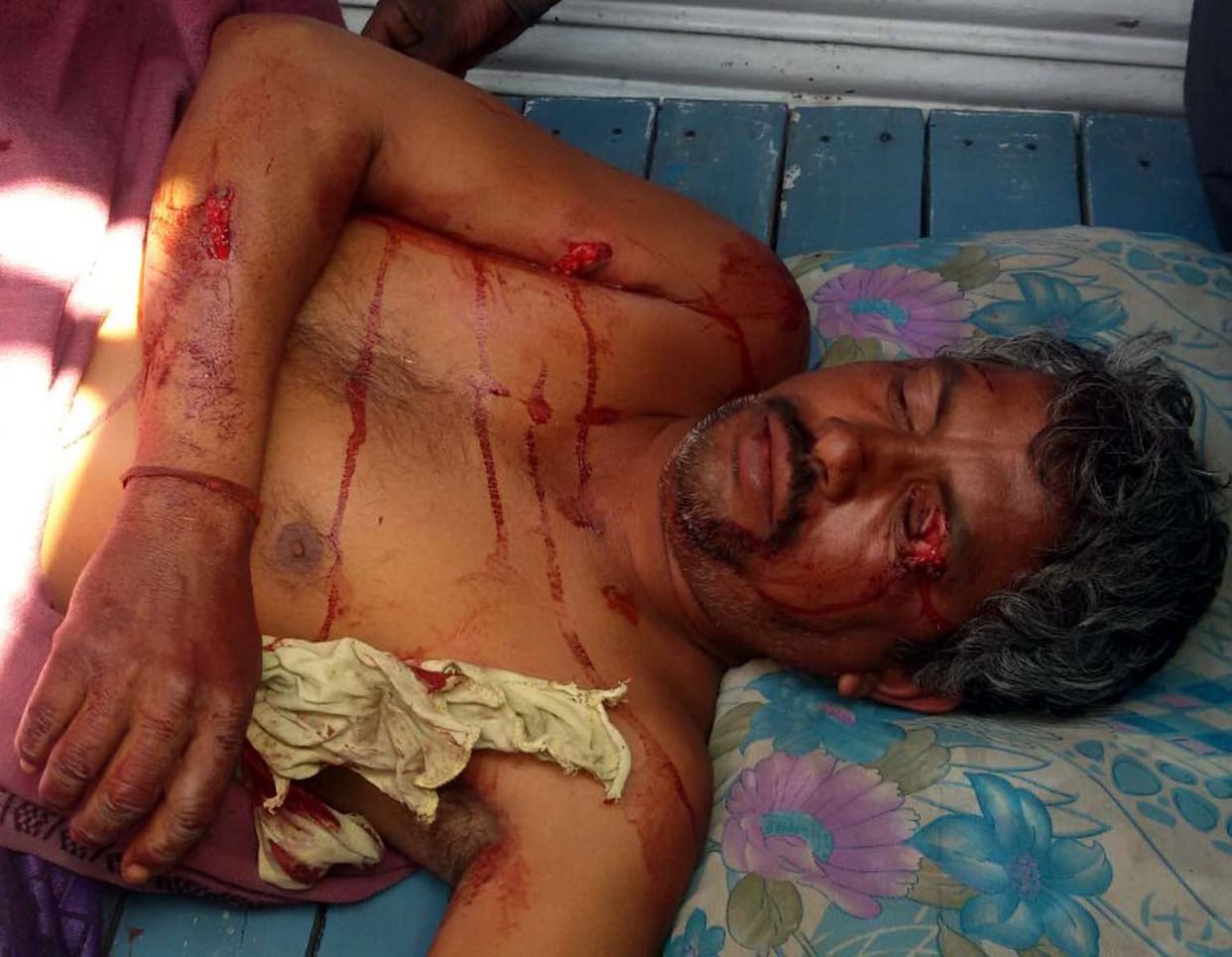 Youth injured tiger attack