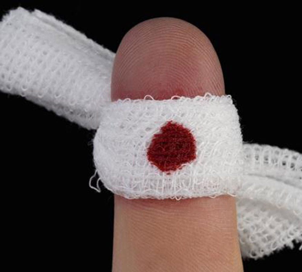 tips to stop bleeding immediately  