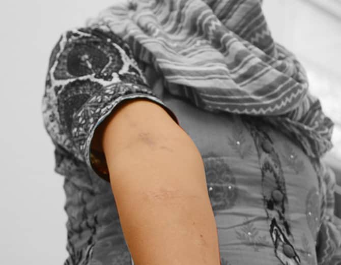 child marriage in chandigarh, 15 years old girl filed case against parents