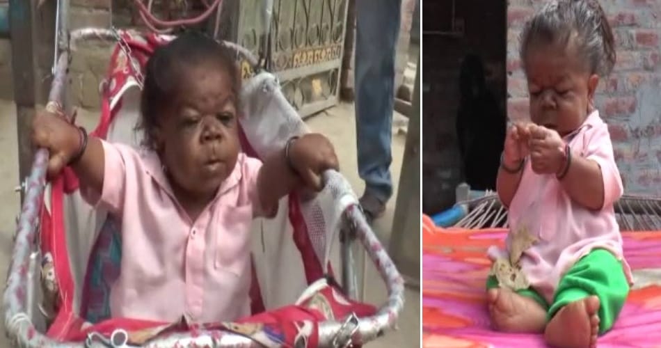 unique child of 22 years old boy named manpreet, height only 23 inch and weight only 7 kg