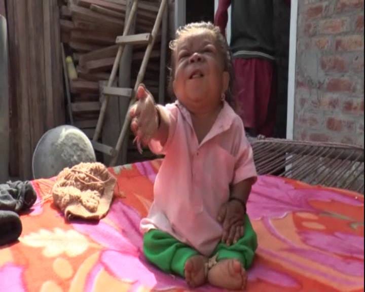 unique child of 22 years old boy named manpreet, height only 23 inch and weight only 7 kg