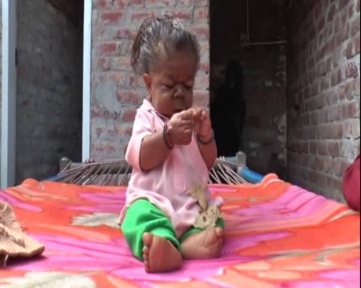 unique child of 22 years old boy named manpreet, height only 23 inch and weight only 7 kg