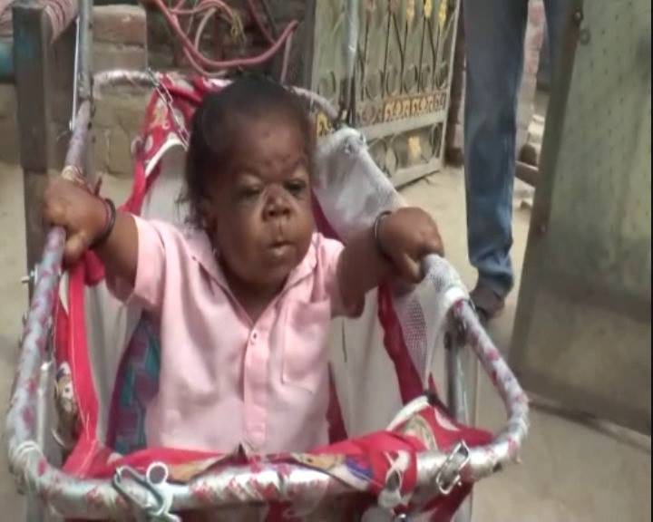 unique child of 22 years old boy named manpreet, height only 23 inch and weight only 7 kg