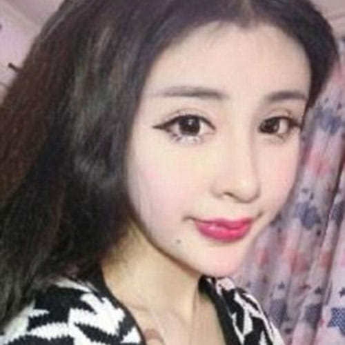 to make boyfriend happy this girl is doing plastic surgery