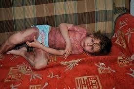  Russian Fire Fairy Game Left 5-Year-Old Girl Seriously Burned.