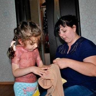  Russian Fire Fairy Game Left 5-Year-Old Girl Seriously Burned.