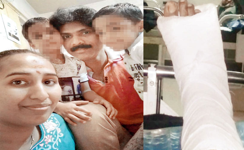 Mumbai: Woman breaks husband's legs with Cricket Bat