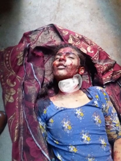 Honor Killing: The father threw the daughter's throat and threw it in front of the lover's house