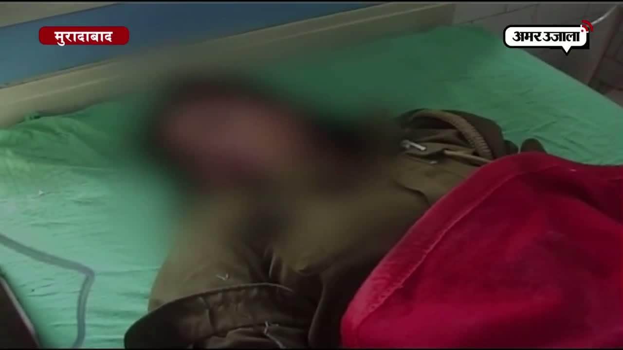 मुरादाबाद में महिला होमगार्ड पर तेजाब से हमला