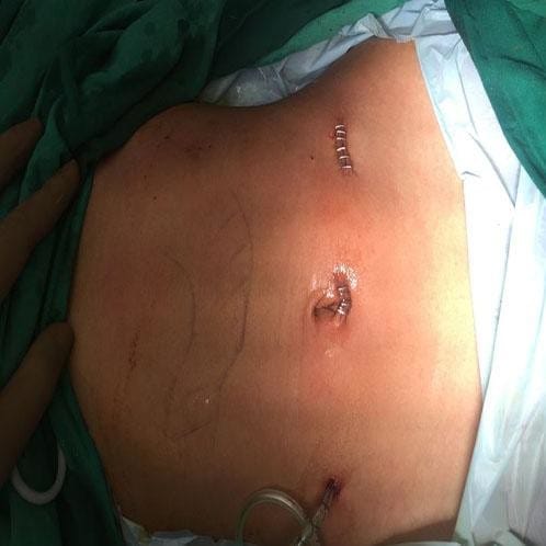 a bunch of hairs release out from a girl stomach. 