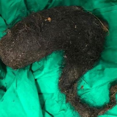 a bunch of hairs release out from a girl stomach. 
