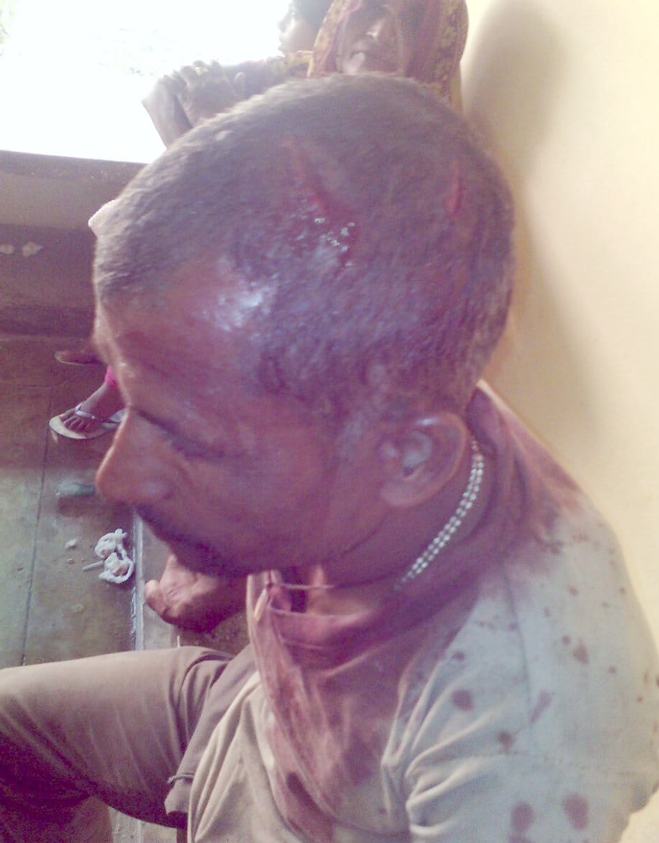 Two wounded in wage, wounded 11