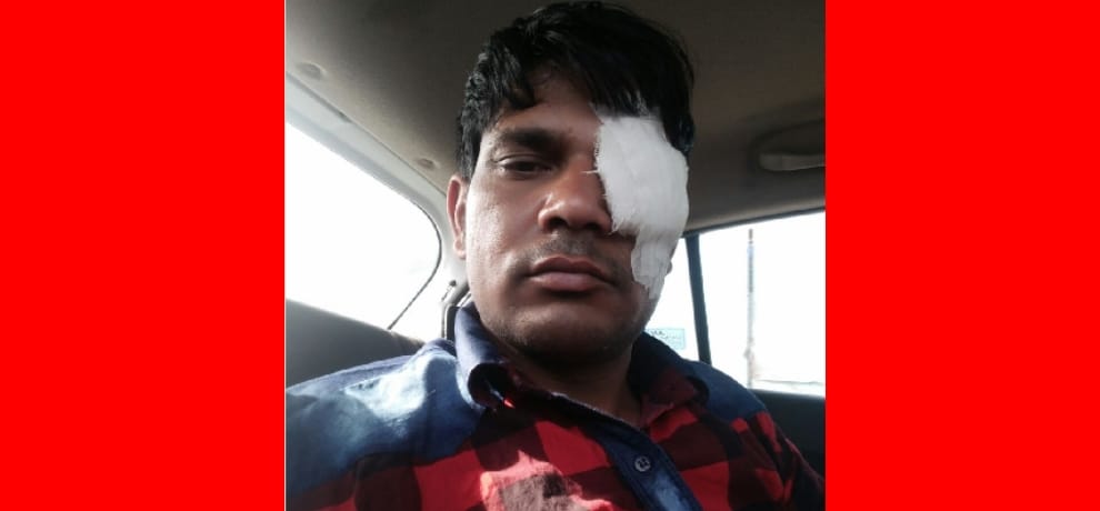 wife took out husband eyes for not giving divorce to her
