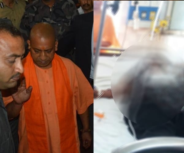  adityanath visits trauma in lucknow.