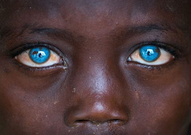 8-Year-Old Boy having blue eyes