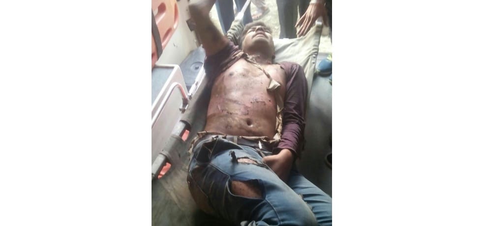 Boy electrocuted while taking selfie atop train in Una Himachal Pradesh