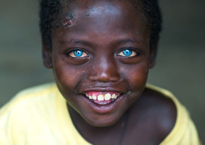 8-Year-Old Boy having blue eyes