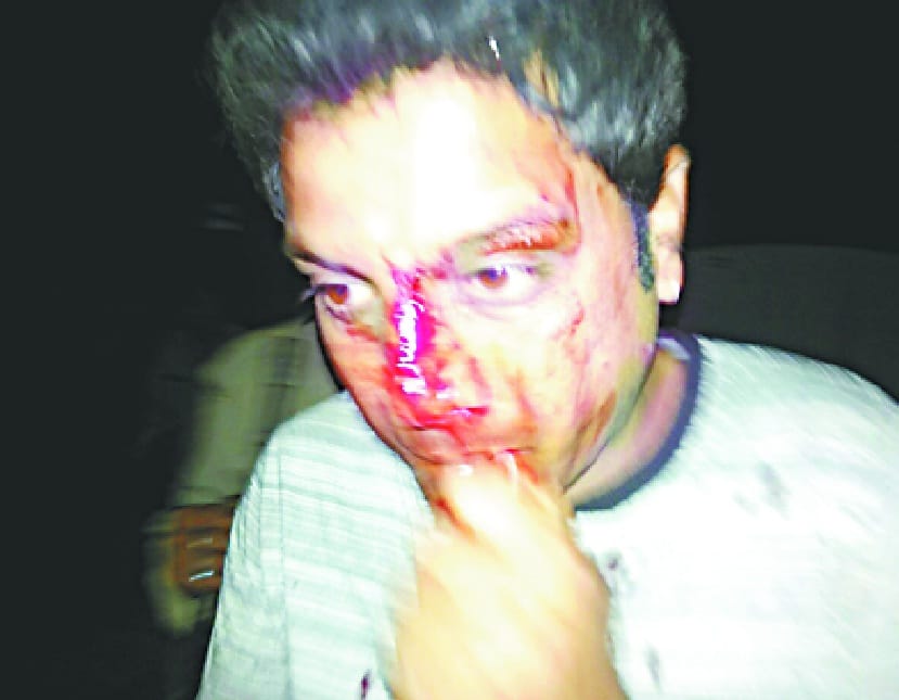 Gokshi accused of meeting plant, BJP leader beaten, Force deployed