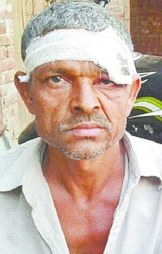 beaten on refuse to lend, five wounded 