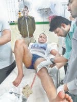 proprty, deler, firing, injurd, hospital, case