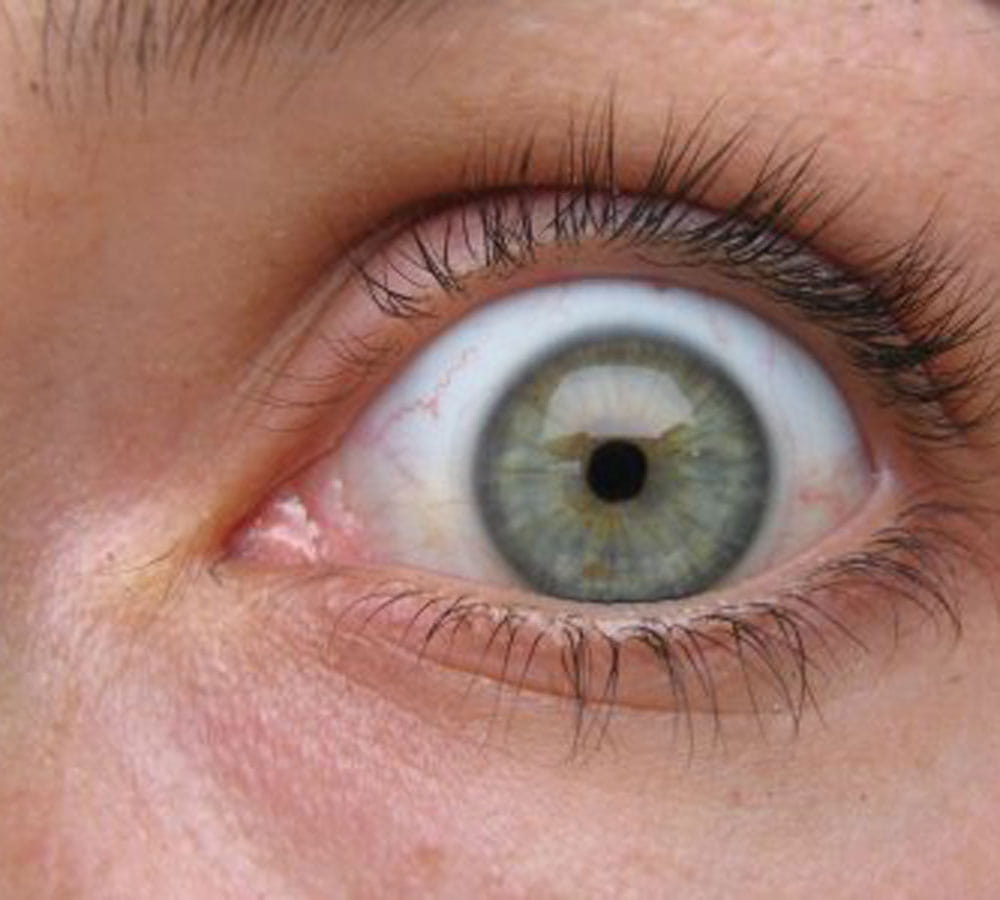 scientific reason why eye starts twitching