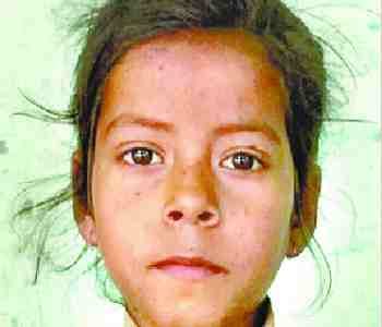 50 people in the grip of chickenpox
