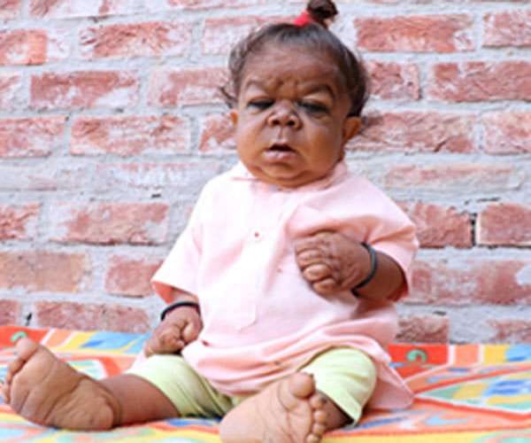 Punjab man just 23 inches tall 