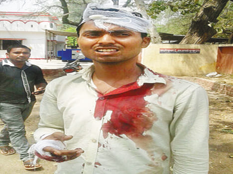 1.25 lakh looted by day-to-day mother and son
