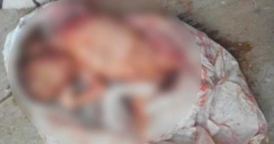 Girl Child Embryo Found in Gutter, Boy Embryo Found in Hospital Toilet