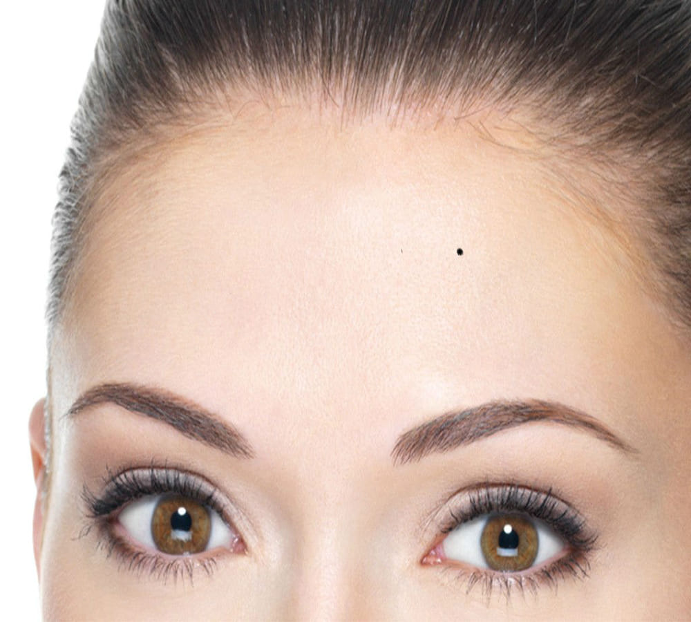 know your moles