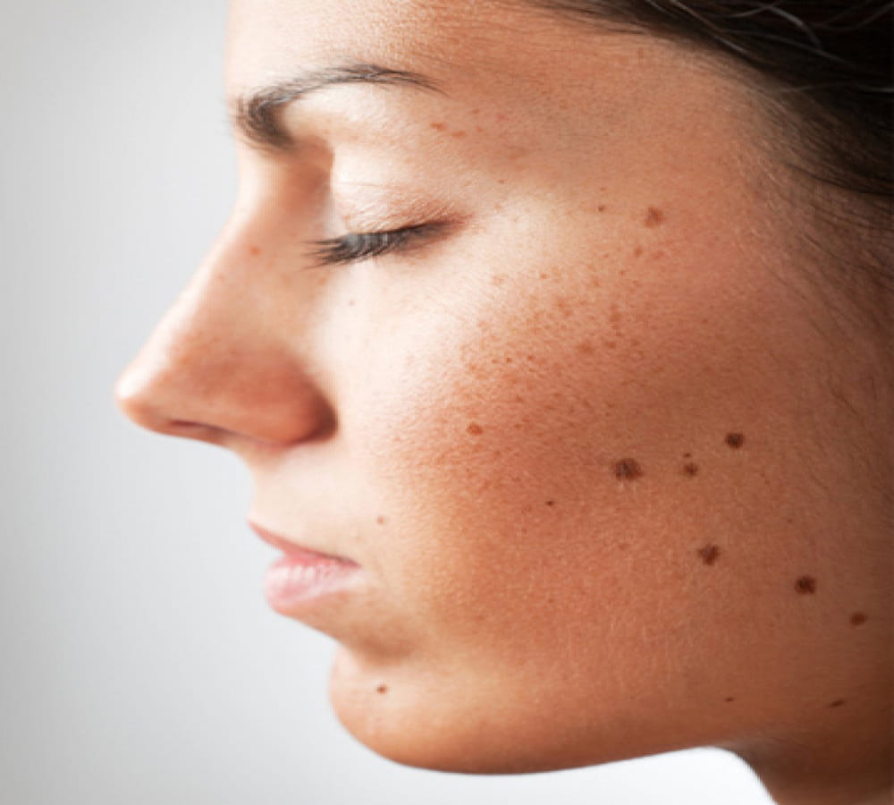 know your moles