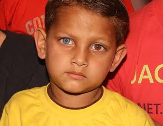 unique boy paras have two colour eyes, one is blue and other is brown