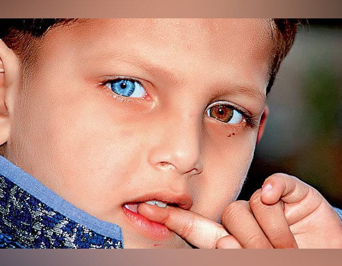 unique boy paras have two colour eyes, one is blue and other is brown