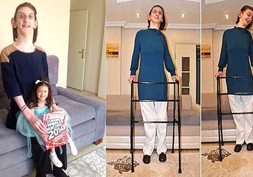 Rumeysa Gelgi is too tall to walk