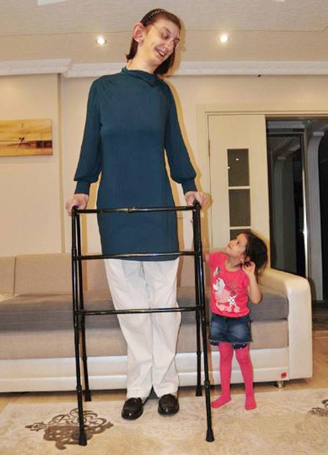 Rumeysa Gelgi is too tall to walk
