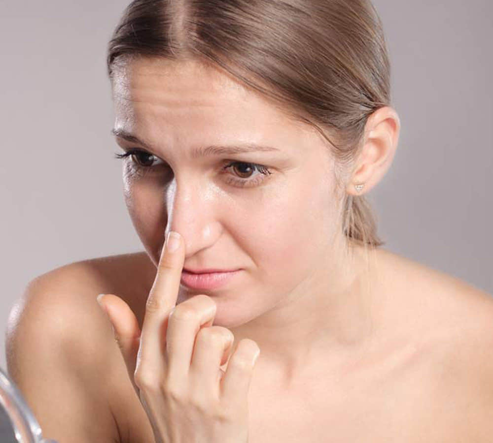 blackheads removal from nose at home with stripe must take care these things