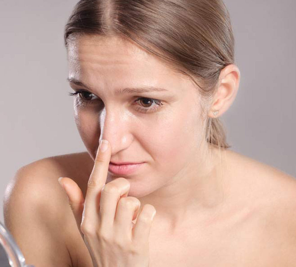 tips to remove black heads at home
