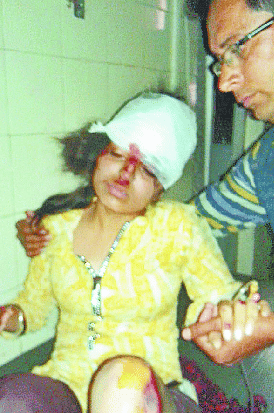 Road accident two Girls on Scooty being injured