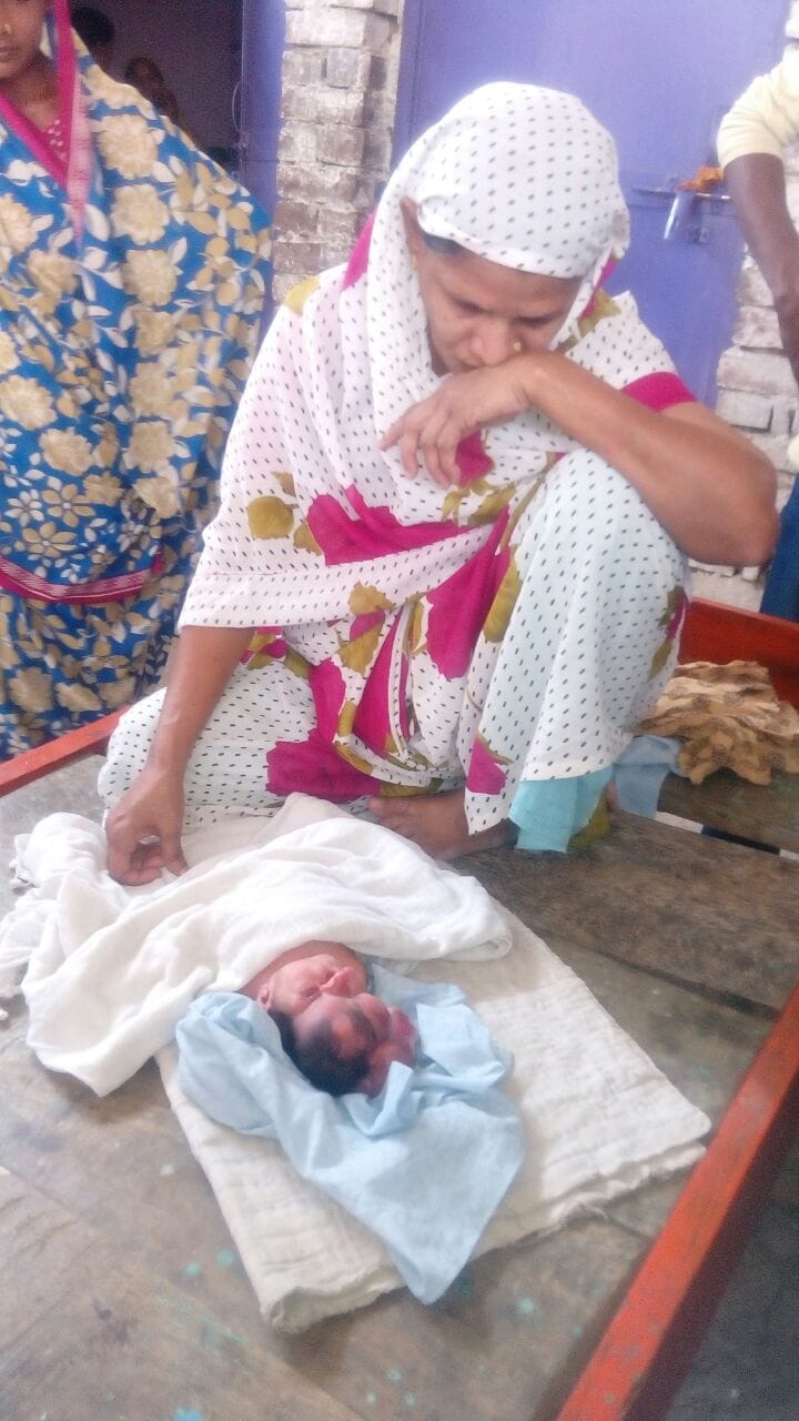 This strange girl born in Varanasi, who had four head 