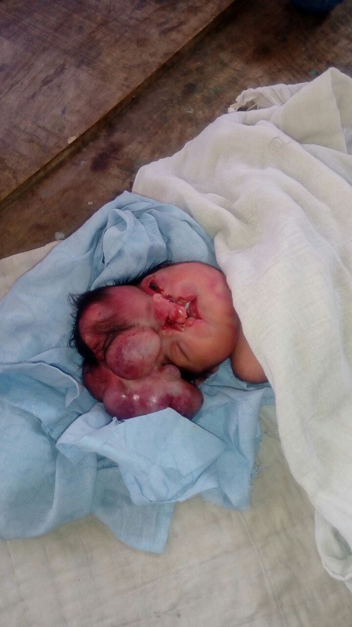 This strange girl born in Varanasi, who had four head 