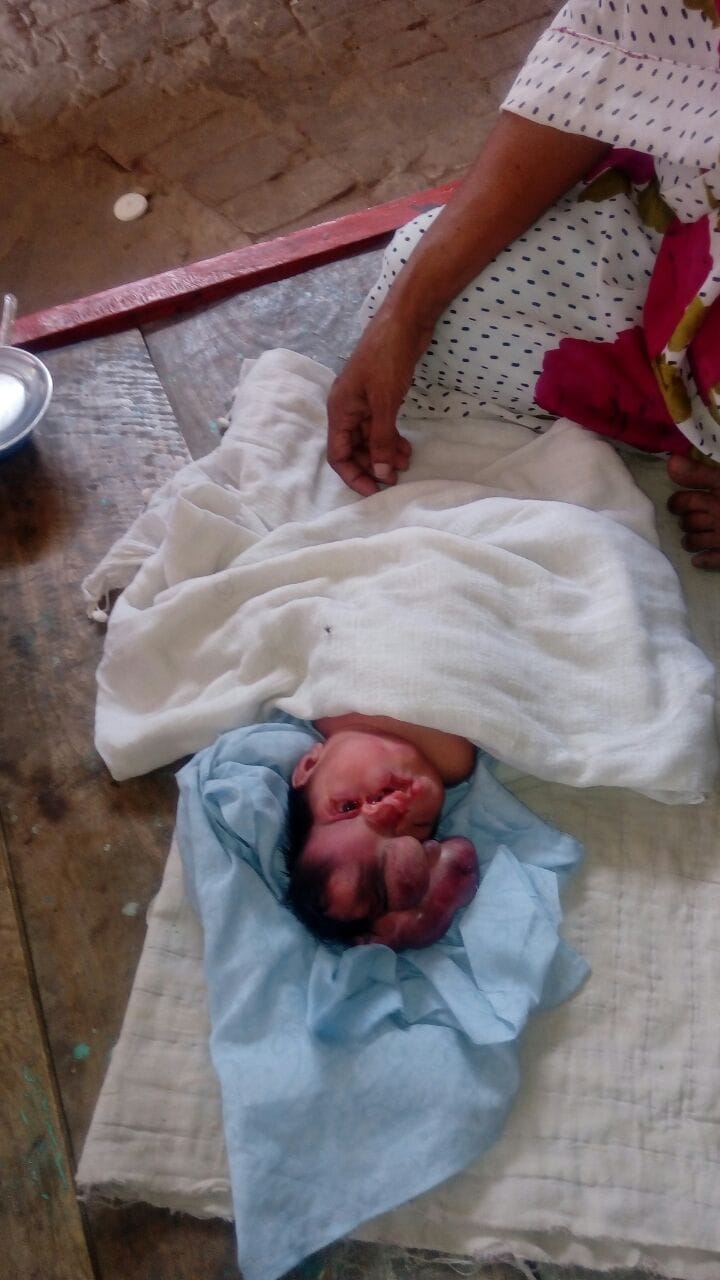 This strange girl born in Varanasi, who had four head 