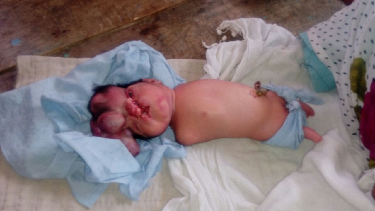 This strange girl born in Varanasi, who had four head 